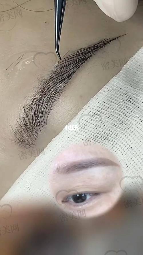 上海九院整复外科：章一新医生的具有影响力风范