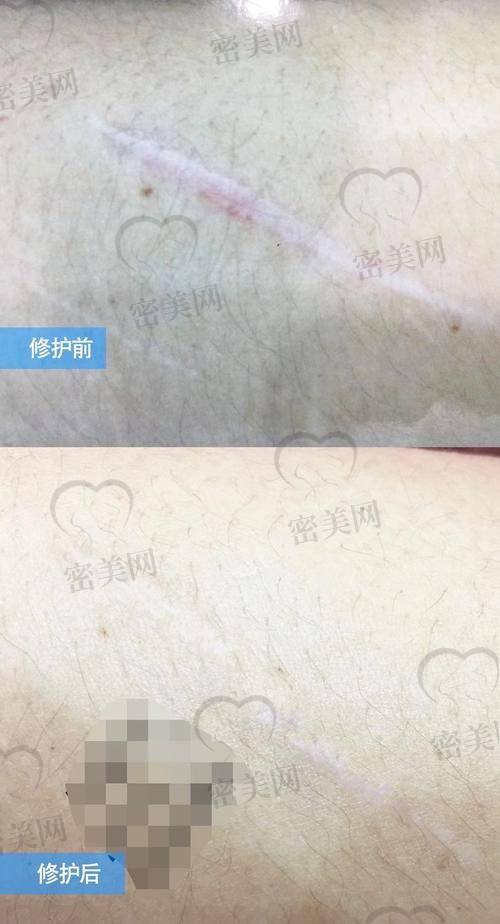 深圳非凡医疗美容医院