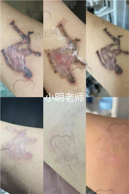 深圳恒生医院医学美容科