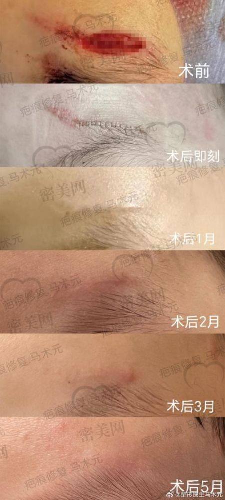 武汉华美整形外科医院