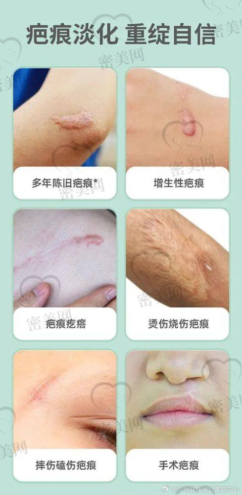 安庆臻妍皮肤美容门诊部