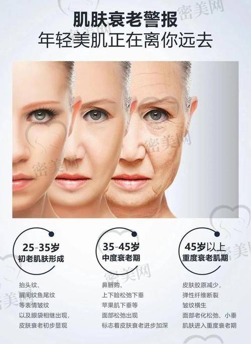 激光去法令纹，副作用有木有？