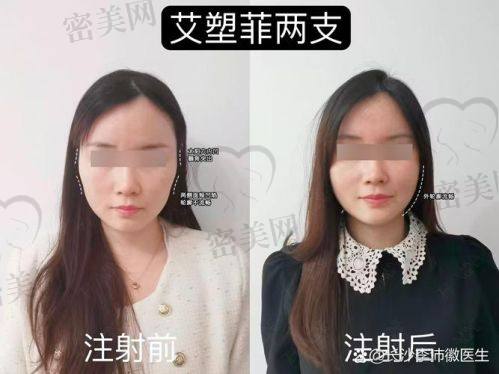 有哪些危害和副作用？