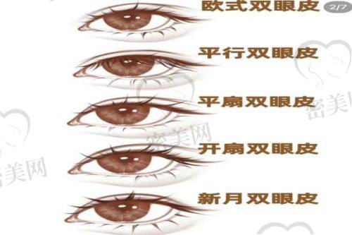 真人实例：见证丽丽眼综合的神奇成效