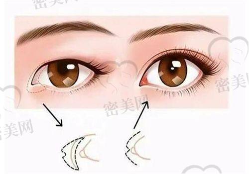 北京丰联丽格医疗美容：眼修复的理想殿堂