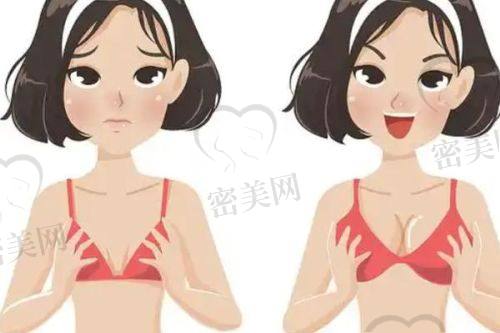 惊了！北京丰联丽格王冀耕医生假体隆胸的真人实例大分享