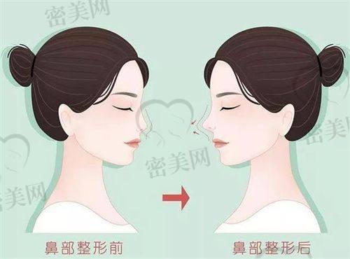 汪奇志医生擅长项目：