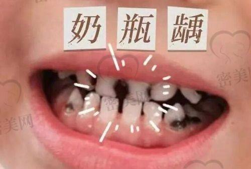 北京佳美口腔医院（华贸店）价格表：