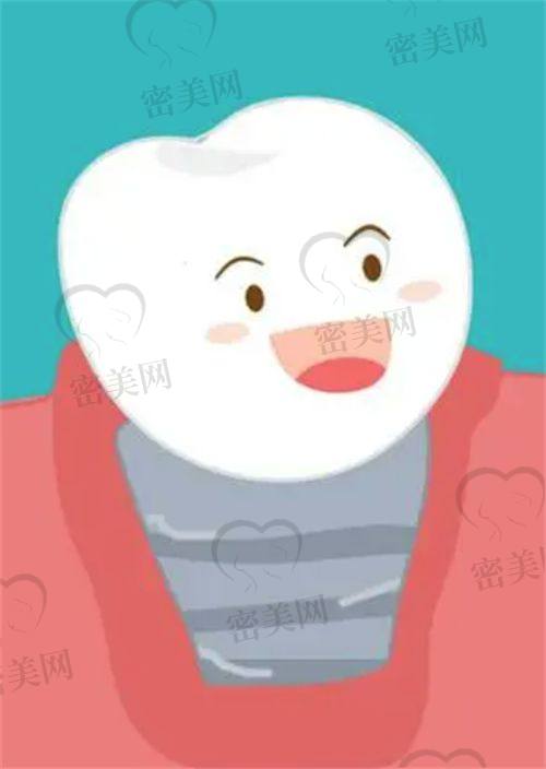 皓圣种植体到底靠谱吗？为什么越来越多医生和患者都在选择它