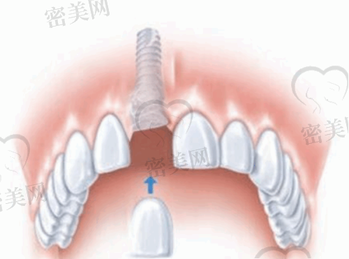 上海鹏强口腔门诊部口碑怎么样？