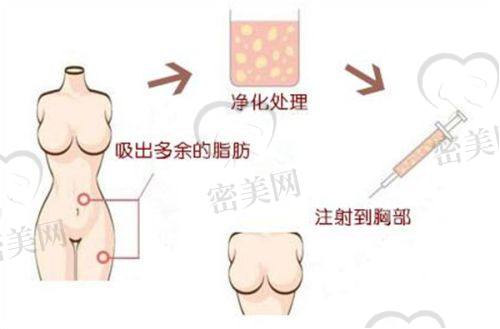 王中秒医生技术特点：