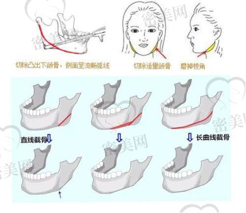 刘至昱医生怎么预约挂号？