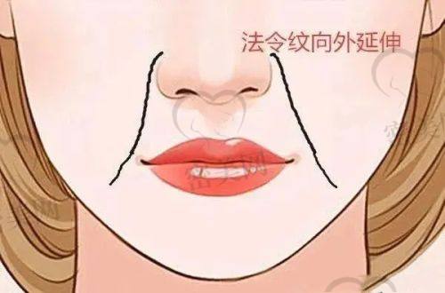 翟亚东医生技术特点：