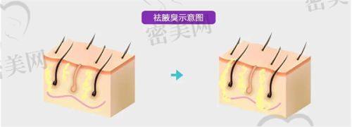 朱柏年医生口碑怎么样？