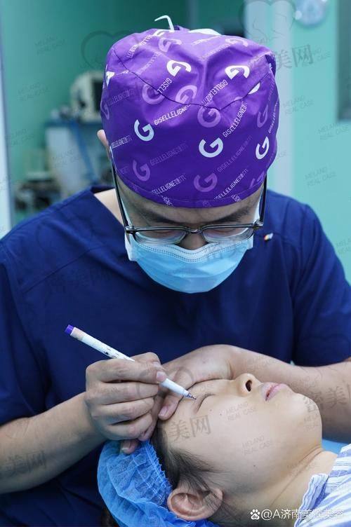 北京吴焱秋双眼皮修复实例视频分享：经典实例超惊艳