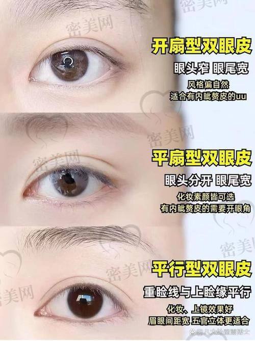 北京丰联丽格：眼综合项目的优质摇篮