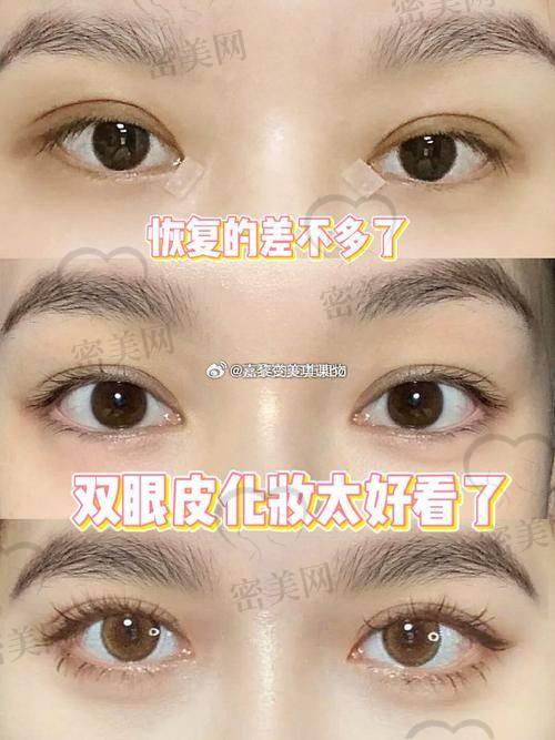 北京丰联丽格丽丽眼综合：价格亲民的变得更美魔法