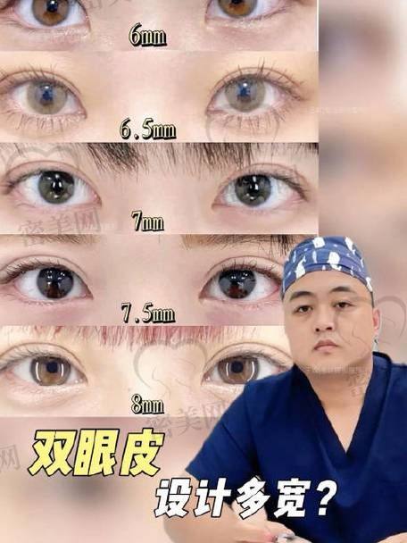 口碑爆棚：北京丰联丽格切开双眼皮受追捧