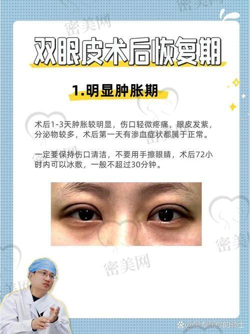 北京丰联丽格王冀耕切开双眼皮：性价比之王来袭！