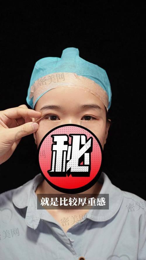 北京丰联丽格医疗美容王冀耕埋线双眼皮：优势大揭秘