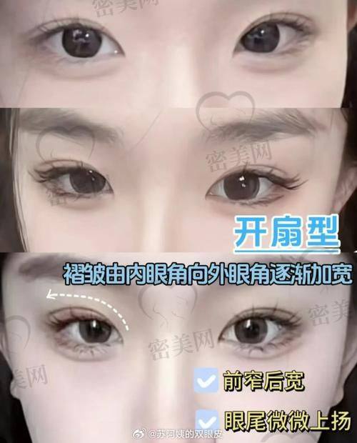 苏州爱思特美容医院