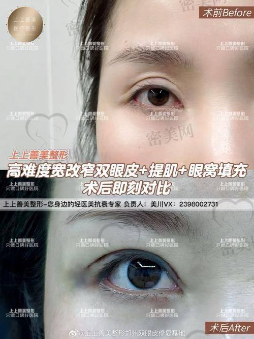 北京丰联丽格：眼综合项目的实力后盾