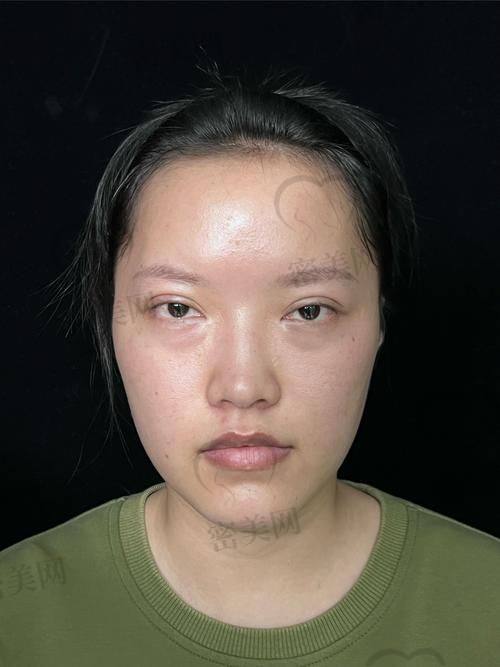 北京丰联丽格医疗美容：切开眼修复的“魔法城堡”