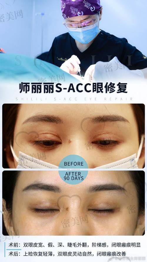 王冀耕眼修复优势：技术大揭秘