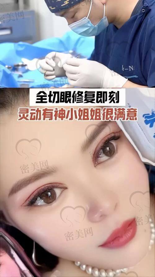 真人实例：北京丰联丽格医疗美容王冀耕切开眼修复的“魔法见证”