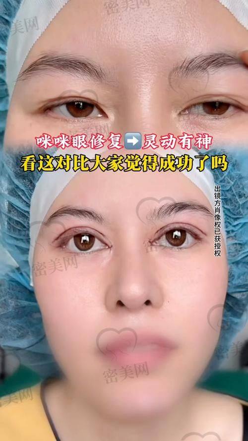王冀耕医生：切开眼修复界的“超级英雄”