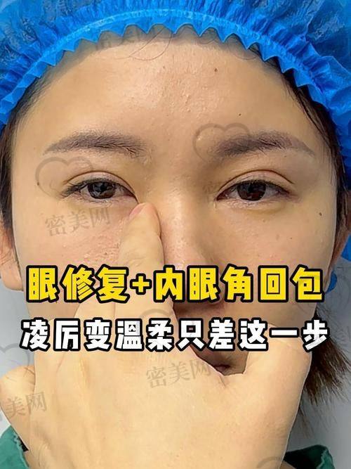 口碑爆棚：北京丰联丽格医疗美容王冀耕切开眼修复的“美丽传说”