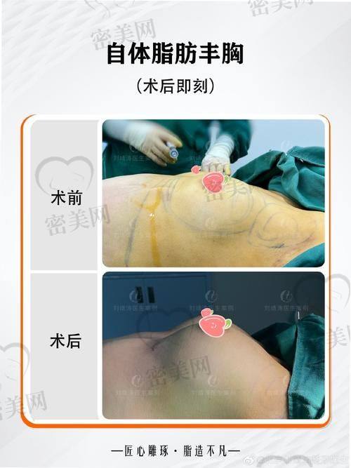 长沙梵童医疗美容门诊部——张龙医生的独特风格