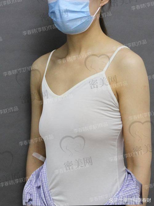 长沙协雅整形美容医院——刘毅医生的严谨态度