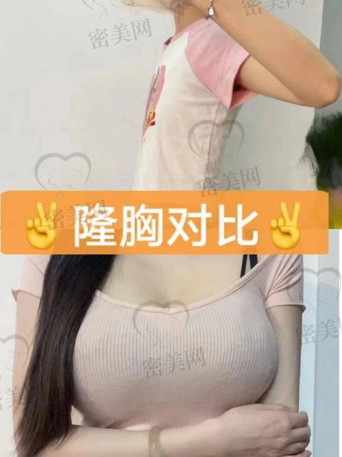 长沙丽都医疗美容医院——罗亮医生的专精素养