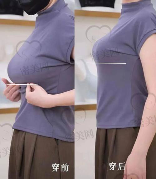 注射视频那些事儿