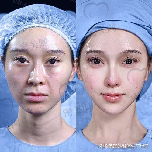 北京美莱王志强医生口碑怎么样啊？技术优势亮瞎眼