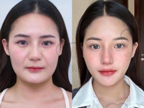 揭秘美莱王志强怎么样？技术优势大曝光