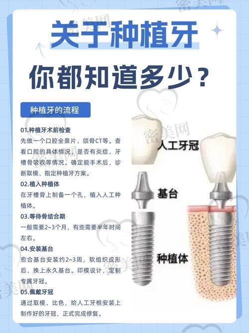 劲松口腔医院重点项目价格范围参考