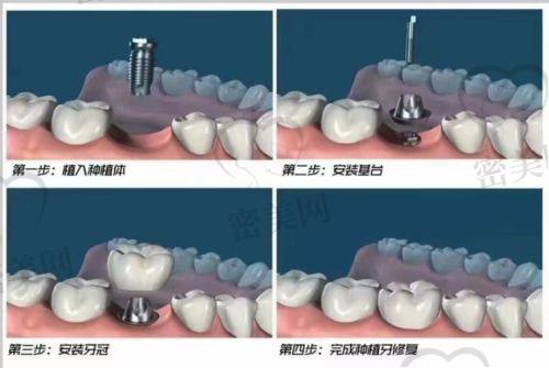深圳万丰医院口腔科医生名单：
