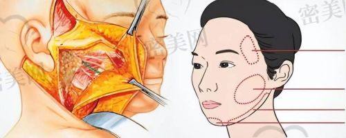 北京美莱王志强：实力医生大揭秘