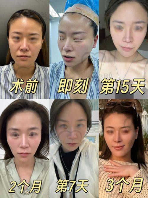 口碑评价：小切口提升的魔法好评