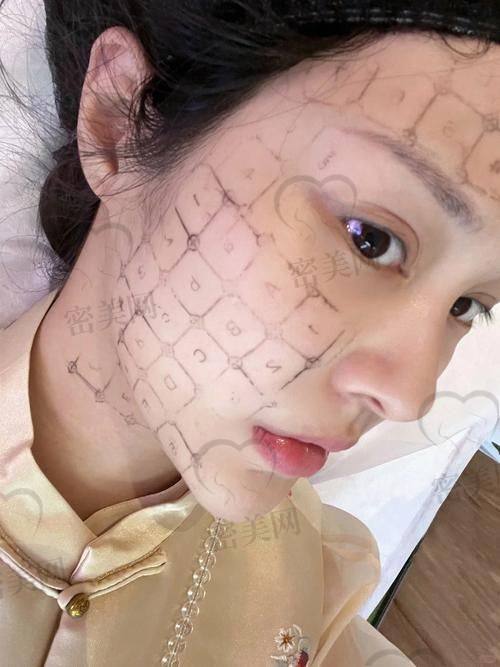 热玛吉与面罩大比拼：谁才是抗衰王者？