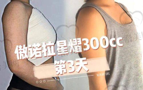 去除抬头纹的整形项目推荐