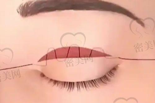 广州壹加壹美容医院：一站式变得更美的欢乐天地