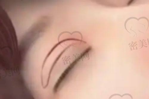 秦琴医生荣誉资质：