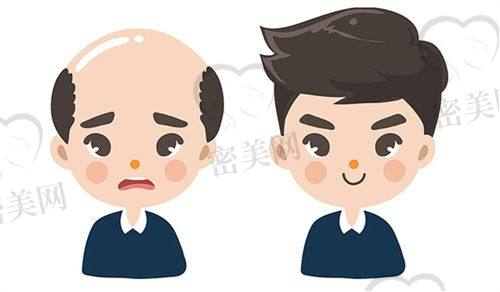 哈尔滨百年植发医院：技术派，主打高密度覆盖