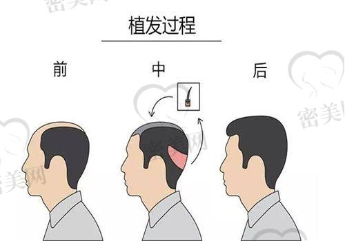 哈尔滨科美植发中 心：新晋口碑王，擅长个性化方案