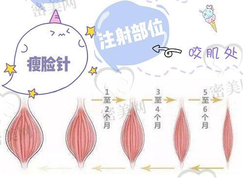 后遗症那些事儿