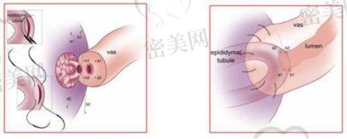 秦琴医生擅长项目：
