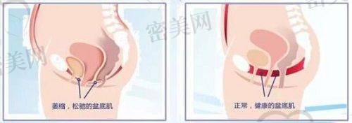 陈孝闯医生擅长项目：